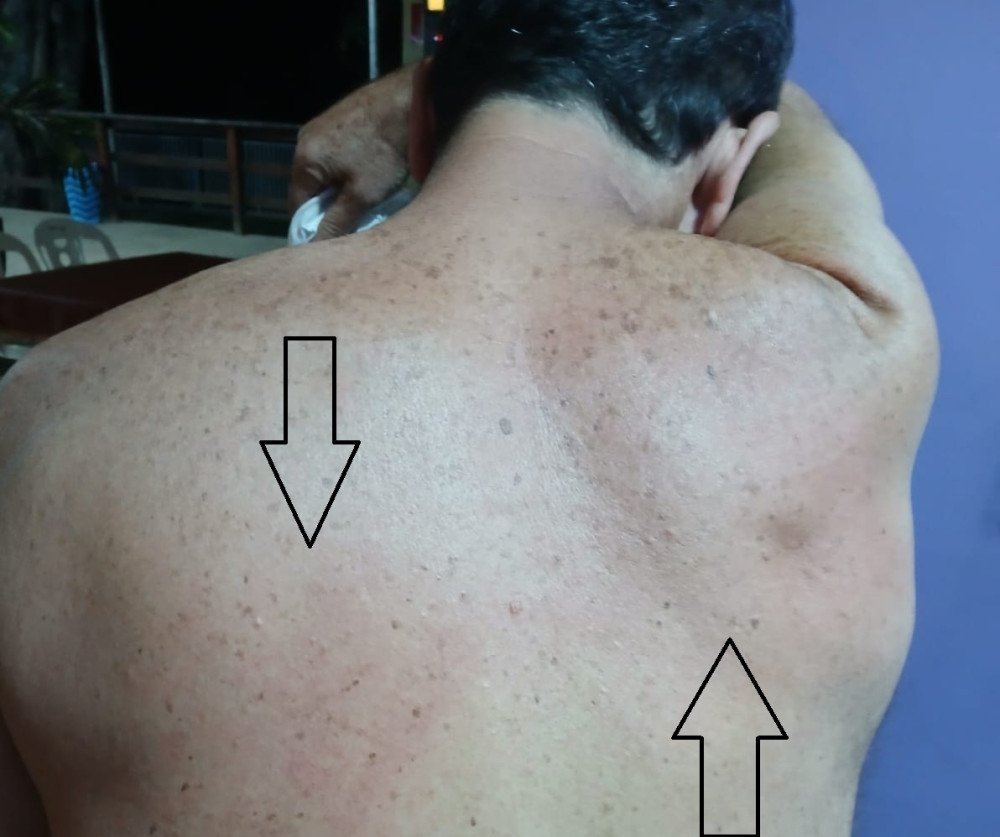 ELEIÇÕES NO INDEPA: INTERVENTOR SUSPENDE ENTRADA DE PABLO BORGES NO CLUBE APÓS O MESMO SER ACUSADO DE ESTAPEAR CONCORRENTE