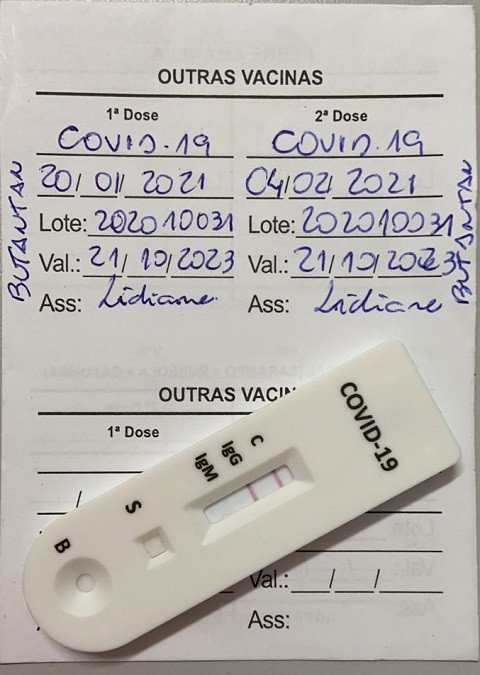 Secretária de Saúde vai fazer amostragem sorológica para avaliar eficácia da vacina contra Covid-19