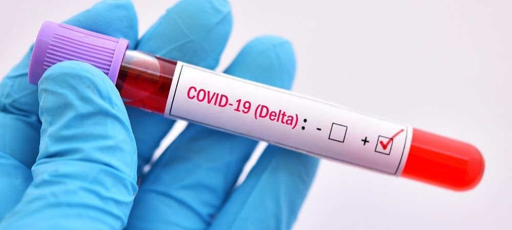 Variante DELTA do Coronavírus circula em Além Paraíba